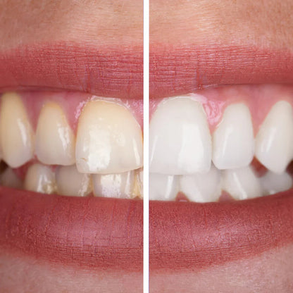 Whitening Toothpaste Tablets